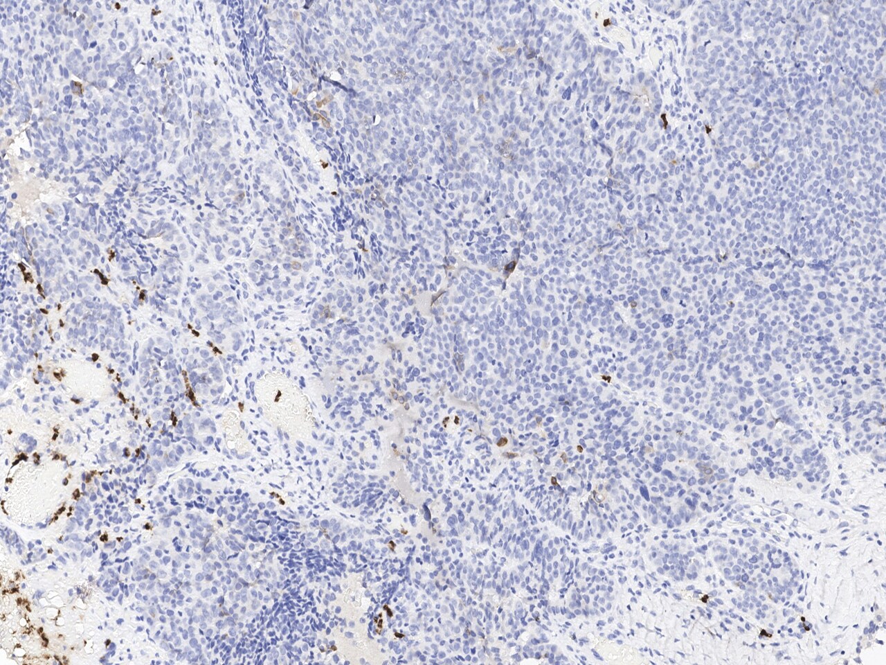 Lipocalin-2/NGAL Antibody (508)