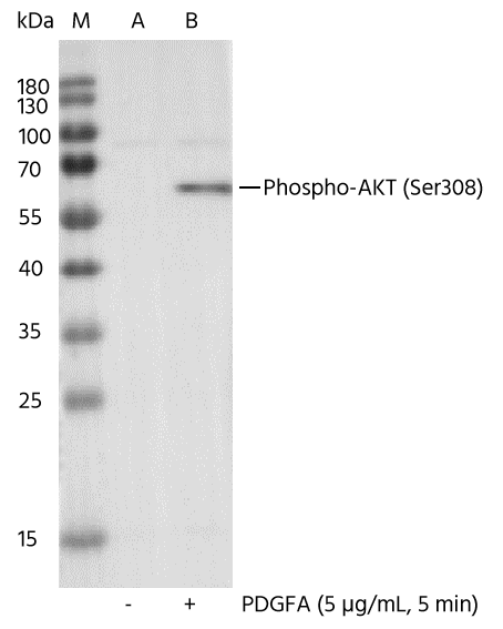 AKT [p Ser308] Antibody (0002) - Azide and BSA Free