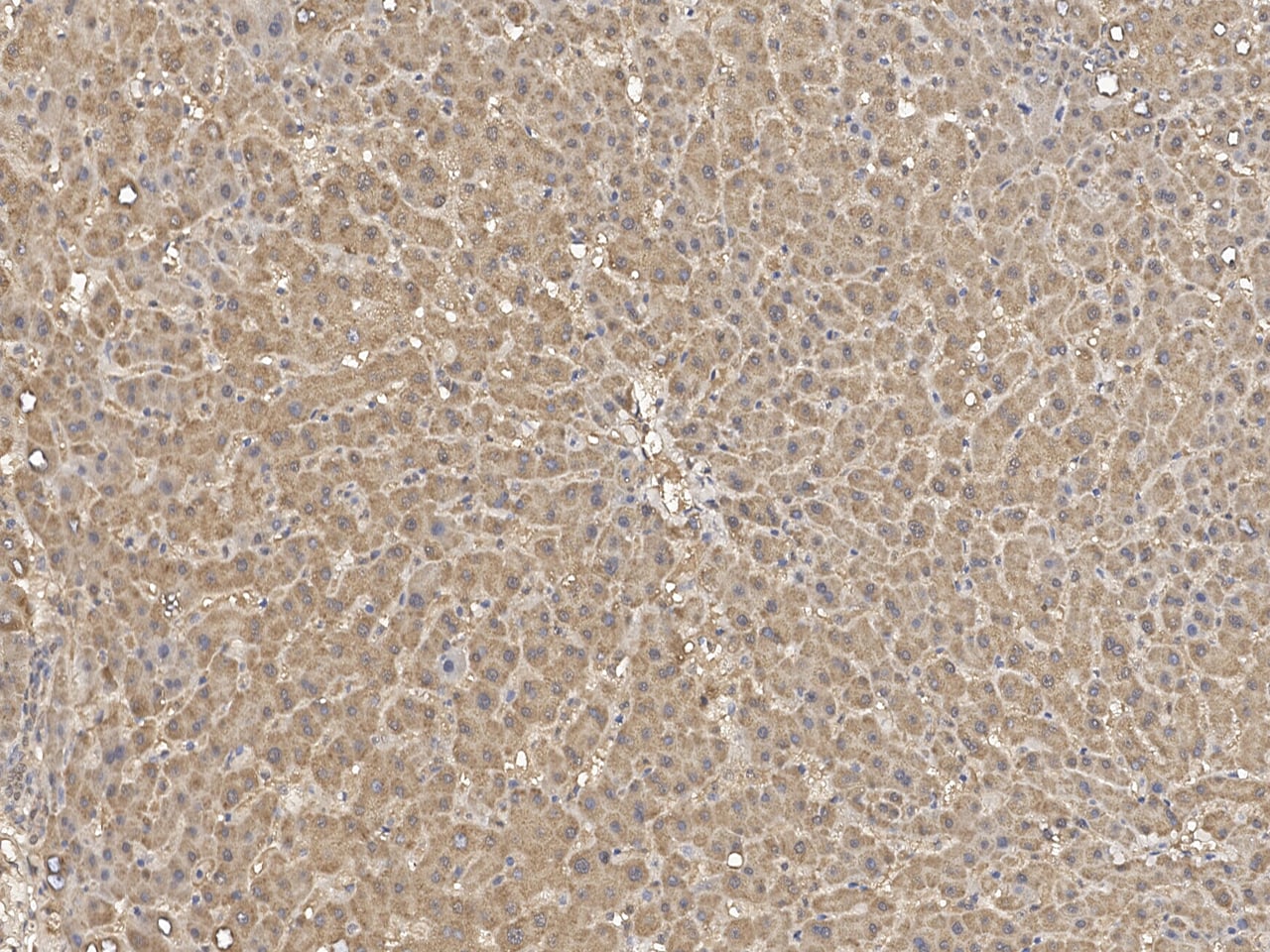 Jade-1/PHF17 Antibody - Azide and BSA Free