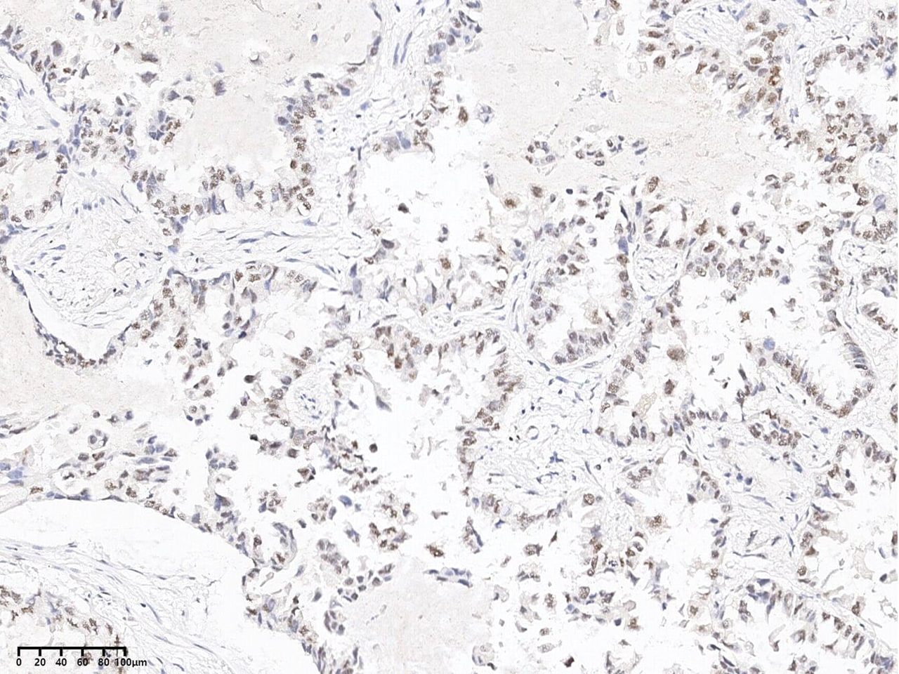 ERK1/ERK2 [p Thr202, p Tyr204] Antibody - Azide and BSA Free