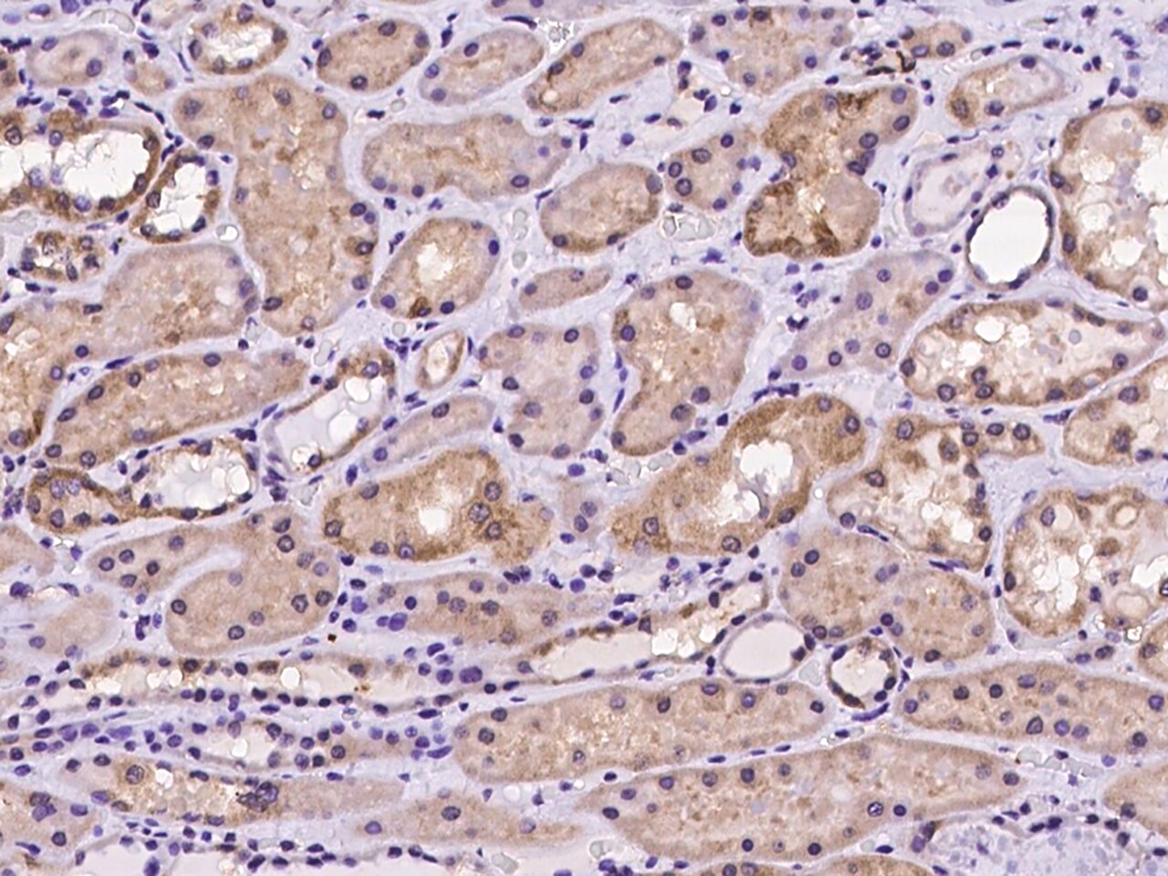 dynactin 4 Antibody - Azide and BSA Free