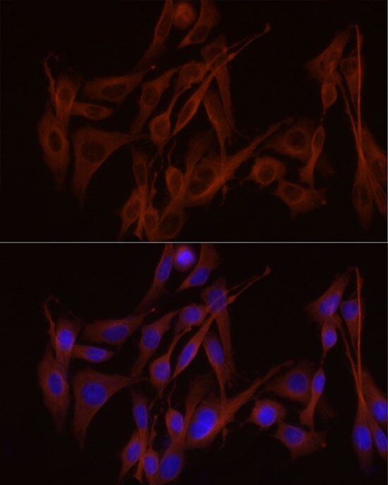 Tubulin alpha-1B Antibody (ARC51243)
