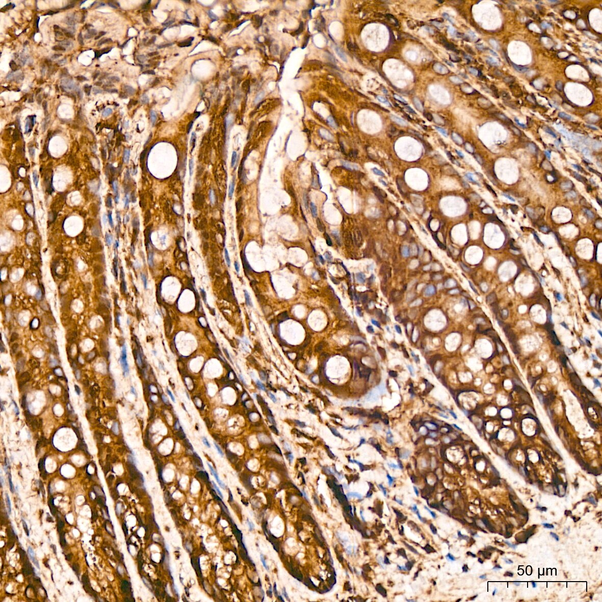 Tubulin alpha-1B Antibody (ARC51243)