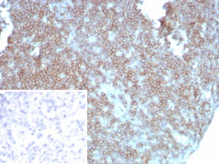 CD27/TNFRSF7 Antibody (LPFS2/8838R) Immunohistochemistry-Paraffin: CD27/TNFRSF7 Antibody (LPFS2/8838R) [NBP3-23582] -