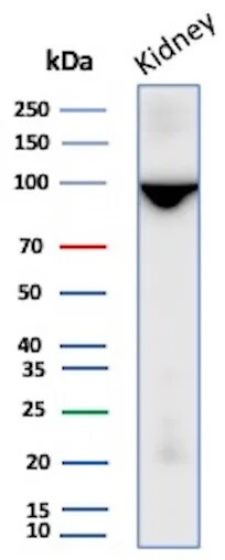 Neprilysin/CD10 Antibody (MME/8281R) Western Blot: Neprilysin/CD10 Antibody (MME/8281R) [NBP3-23588] -