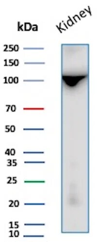 Neprilysin/CD10 Antibody (MME/8281R) Western Blot: Neprilysin/CD10 Antibody (MME/8281R) [NBP3-23588] -