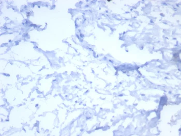 ErbB2/Her2 Antibody (ERBB2/7158R) Immunohistochemistry-Paraffin: ErbB2/Her2 Antibody (ERBB2/7158R) [NBP3-23595] -