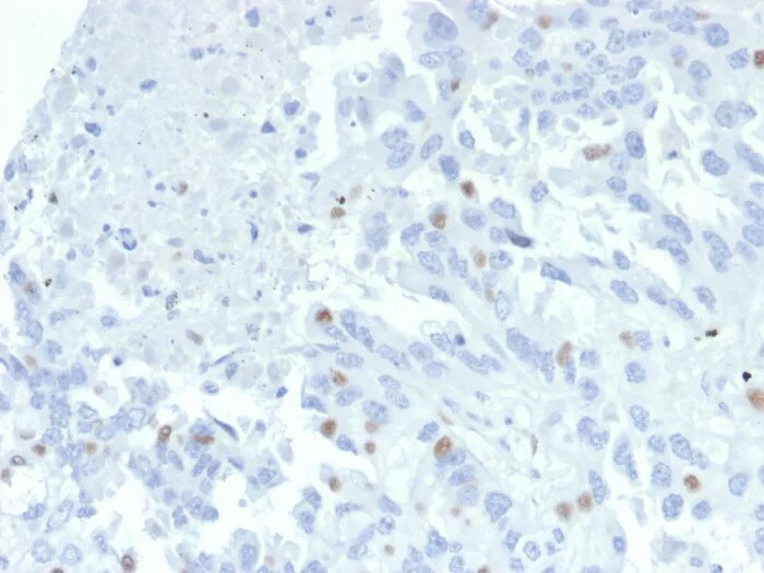 ZNF232 Antibody (PCRP-ZNF232-2B3) Immunohistochemistry-Paraffin: ZNF232 Antibody (PCRP-ZNF232-2B3) [NBP3-23598] -