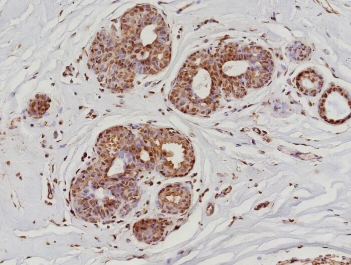 RNA Polymerase II/POLR2A Antibody (POLR2A/9089R) Immunohistochemistry-Paraffin: RNA Polymerase II/POLR2A Antibody (POLR2A/9089R) [NBP3-23600] -