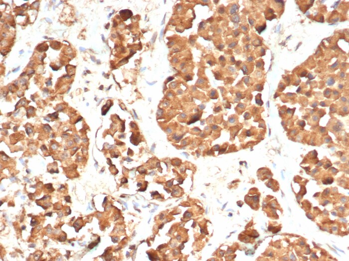 ACTH Antibody (CLIP/7197R)
