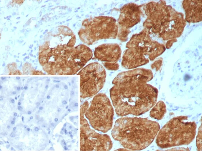 FABP1/L-FABP Antibody (FABP1/9085R) Immunohistochemistry-Paraffin: FABP1/L-FABP Antibody (FABP1/9085R) [NBP3-23602] -
