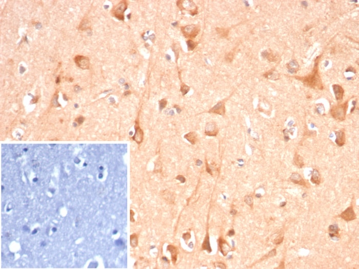 Adenylate Cyclase 8 Antibody (ADCY8/7341)