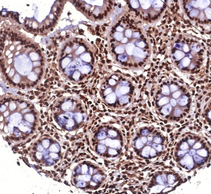 HspA1B Antibody (HSPA1B/7621)