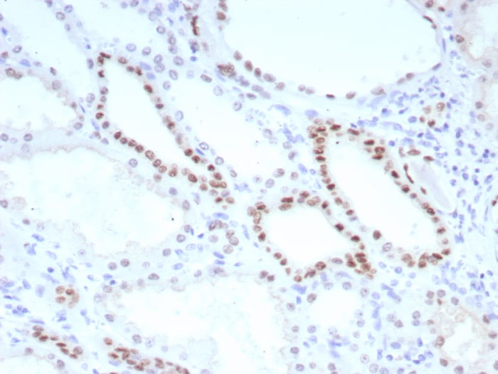 PAX8 Antibody (PAX8/8651R)