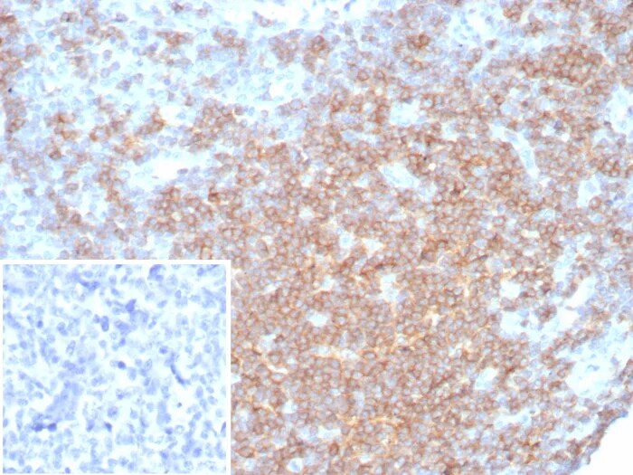 CD27/TNFRSF7 Antibody (LPFS2/8316R) Immunohistochemistry-Paraffin: CD27/TNFRSF7 Antibody (LPFS2/8316R) [NBP3-23618] -
