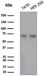 HspA1B Antibody (HSPA1B/7625)