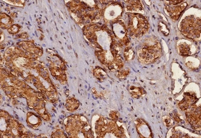 Cytokeratin, pan Antibody (MonoPoly/4999R) Immunohistochemistry-Paraffin: Cytokeratin, pan Antibody (MonoPoly/4999R) [NBP3-23627] -