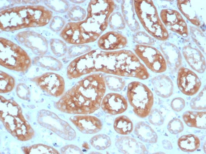 Adenylate Cyclase 8 Antibody (ADCY8/7574)