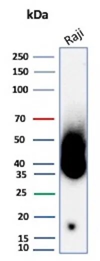 CD38 Antibody (CD38/8335R) Western Blot: CD38 Antibody (CD38/8335R) [NBP3-23632] -