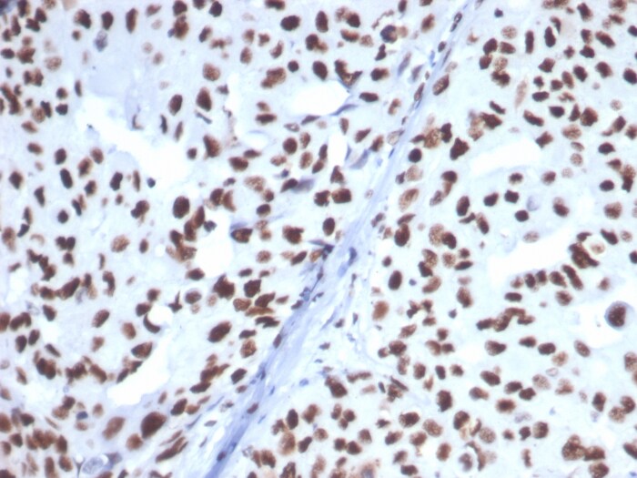 HspA1B Antibody (HSPA1B/7628)