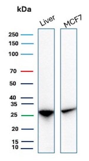 HSP27 Antibody (rHSPB1/7298) Western Blot: HSP27 Antibody (rHSPB1/7298) [NBP3-23637] -