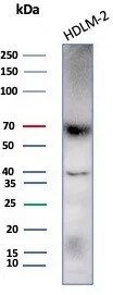 Perforin Antibody (rPRF1/8058) Western Blot: Perforin Antibody (rPRF1/8058) [NBP3-23638] -