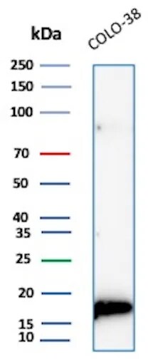 Melan-A/MART-1 Antibody (rMLANA/9404) Western Blot: Melan-A/MART-1 Antibody (rMLANA/9404) [NBP3-23643] -