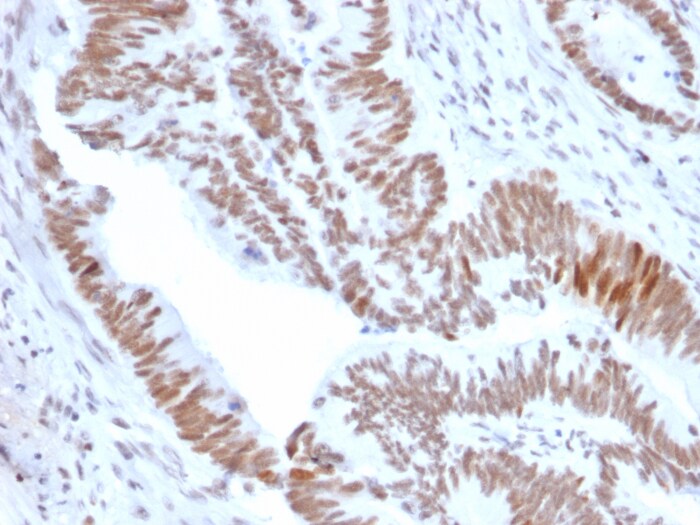 DBC1/p30 Antibody (PCRP-KIAA1967-1D10)