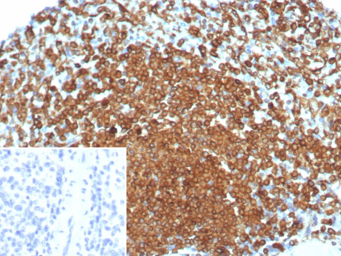 CD74 Antibody (rCLIP/8679)