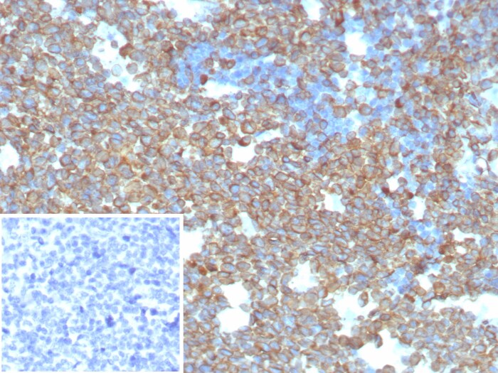 CD74 Antibody (CLIP/8680R)