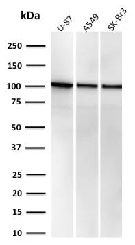MVP Antibody (r1032) Western Blot: MVP Antibody (r1032) [NBP3-23652] -