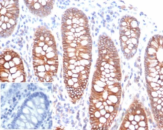 E-Cadherin Antibody (rCDH1/6769) Immunohistochemistry-Paraffin: E-Cadherin Antibody (rCDH1/6769) [NBP3-23653] -