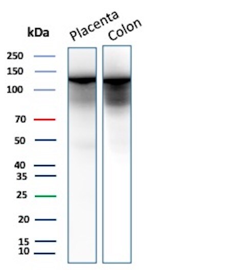 E-Cadherin Antibody (rCDH1/6769) Western Blot: E-Cadherin Antibody (rCDH1/6769) [NBP3-23653] -