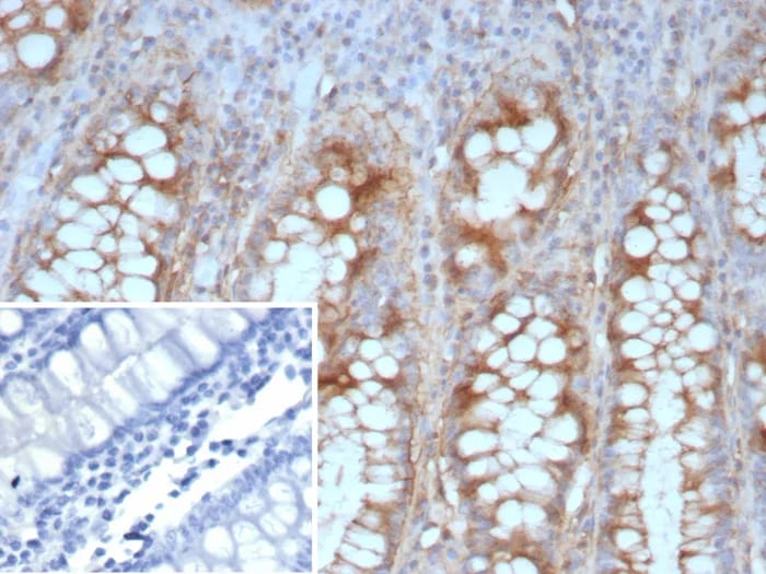 E-Cadherin Antibody (CDH1/9226R) Immunohistochemistry-Paraffin: E-Cadherin Antibody (CDH1/9226R) [NBP3-23654] -