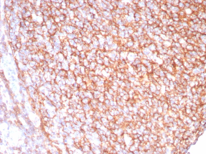 CD21 Antibody (CR2/8880R)