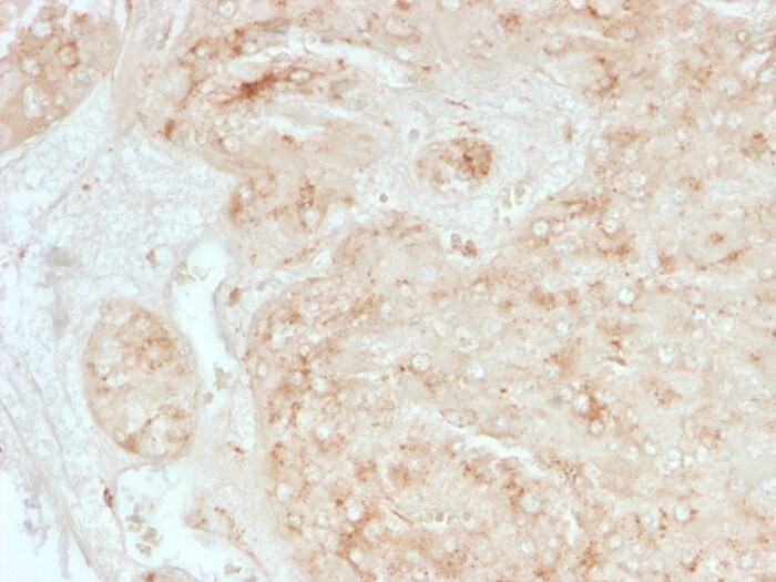 StAR Antibody (STAR/3976)