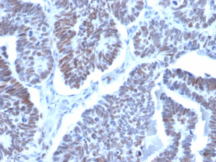 LDB2 Antibody (PCRP-LDB2-1B10)