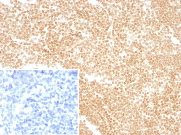 LDB2 Antibody (PCRP-LDB2-1B10)