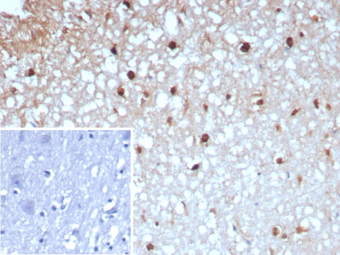 Glutamine Synthetase Antibody (GLUL/8996R)