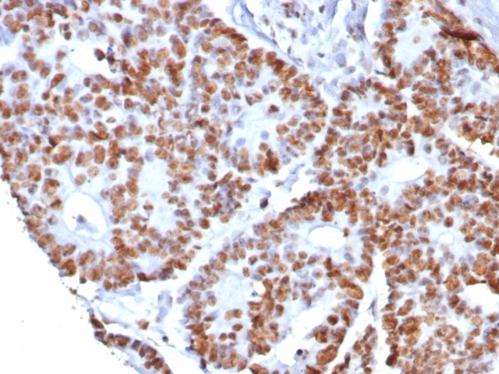 Nucleolin Antibody (NCL/8068R)