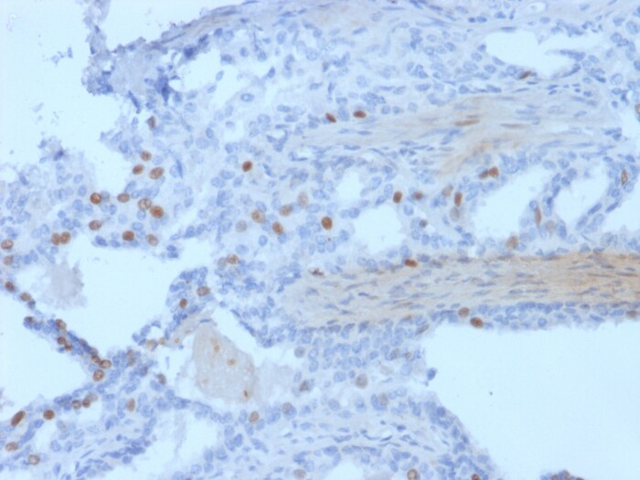 PCGF3 Antibody (PCRP-PCGF3-1D5)