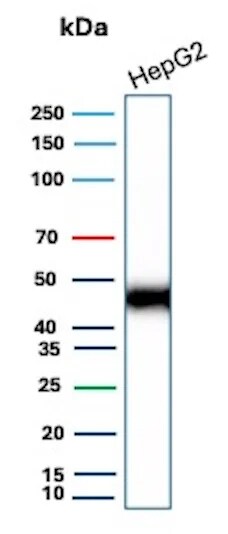 EMMPRIN/CD147 Antibody (BSG/9223R) Western Blot: EMMPRIN/CD147 Antibody (BSG/9223R) [NBP3-23674] -