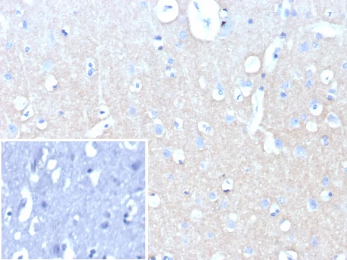 L1CAM Antibody (L1CAM/9146R) Immunohistochemistry-Paraffin: L1CAM Antibody (L1CAM/9146R) [NBP3-23681] -