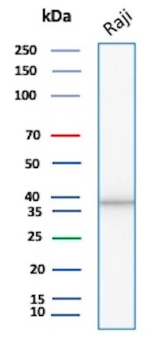PCNA Antibody (rPCNA/8859) Western Blot: PCNA Antibody (rPCNA/8859) [NBP3-23682] -