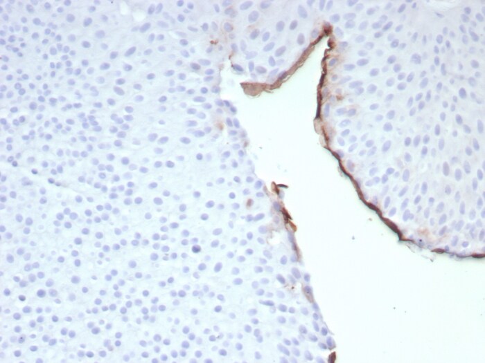 Uroplakin IIIB Antibody (UPK3B/8768R)