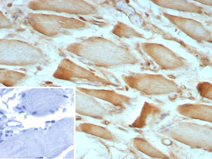 ZNF804A Antibody (ZNF804A/8945)