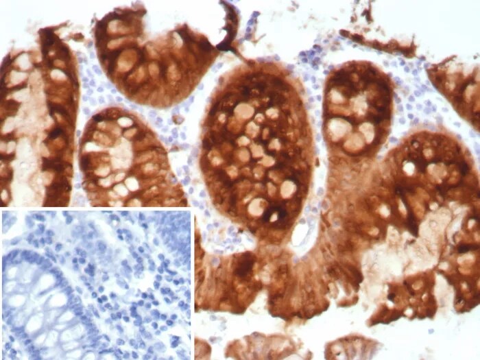 TFF1/pS2 Antibody (TFF1/8817R) Immunohistochemistry-Paraffin: TFF1/pS2 Antibody (TFF1/8817R) [NBP3-23692] -