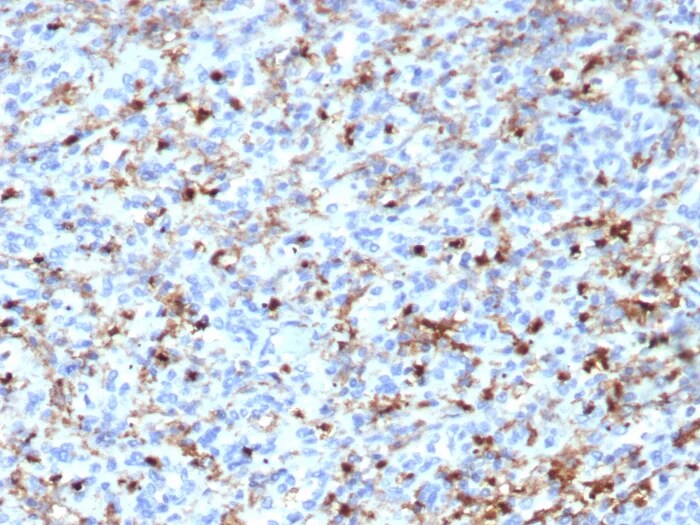 CD163L1 Antibody (CD163L1/7971) Immunohistochemistry-Paraffin: CD163L1 Antibody (CD163L1/7971) [NBP3-23697] -