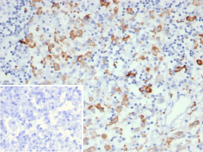 CD163L1 Antibody (CD163L1/7971) Immunohistochemistry-Paraffin: CD163L1 Antibody (CD163L1/7971) [NBP3-23697] -
