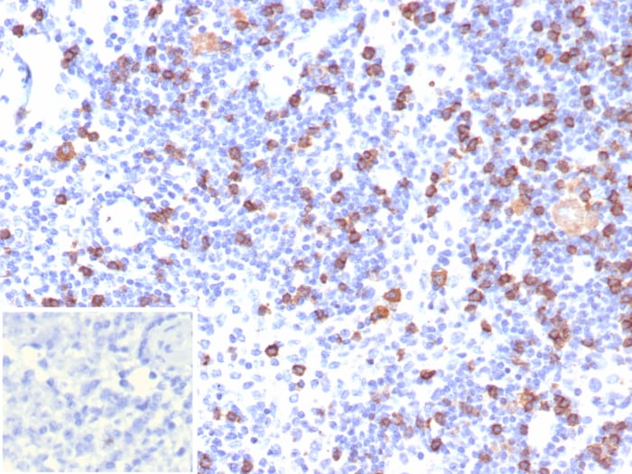 CD8 Antibody (CD8/7793R)